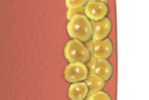 Weight loss treatment