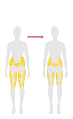 After Weight Loss